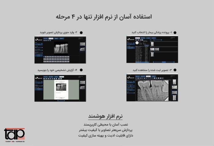 سنسور رادیوگرافی Eighteeth | NanoPix